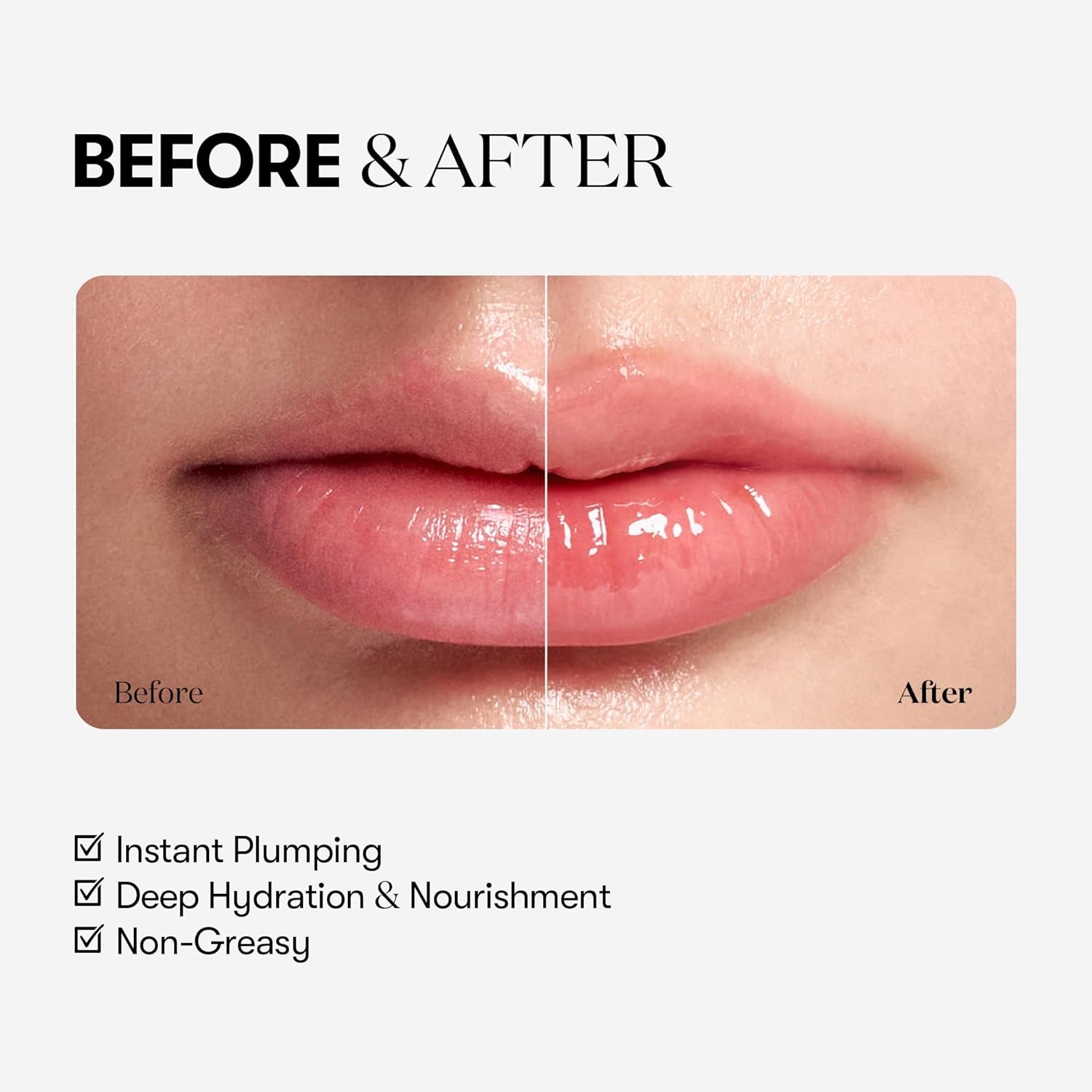 Reedle Shot Lip Plumper, Hydrating & Volumizing Clear Lip Gloss, Microneedling Effect & Hyaluronic Acid for Fuller, Smoother Lips, 0.15 Oz (4.3 G) (Beginner)